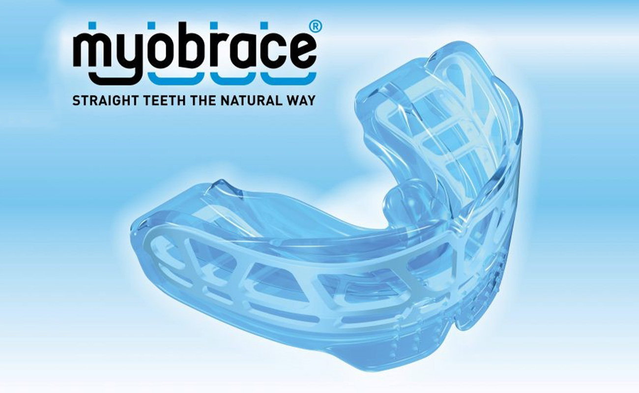 Interceptive Orthodontics